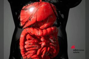 Guselkumab rimborsabile per colite ulcerosa e Crohn: approvate due nuove indicazioni in Italia