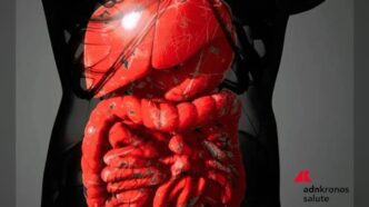 Guselkumab rimborsabile per colite ulcerosa e Crohn: approvate due nuove indicazioni in Italia