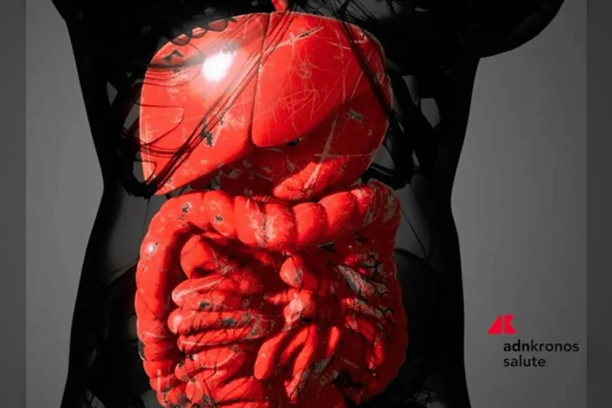 Guselkumab rimborsabile per colite ulcerosa e Crohn: approvate due nuove indicazioni in Italia