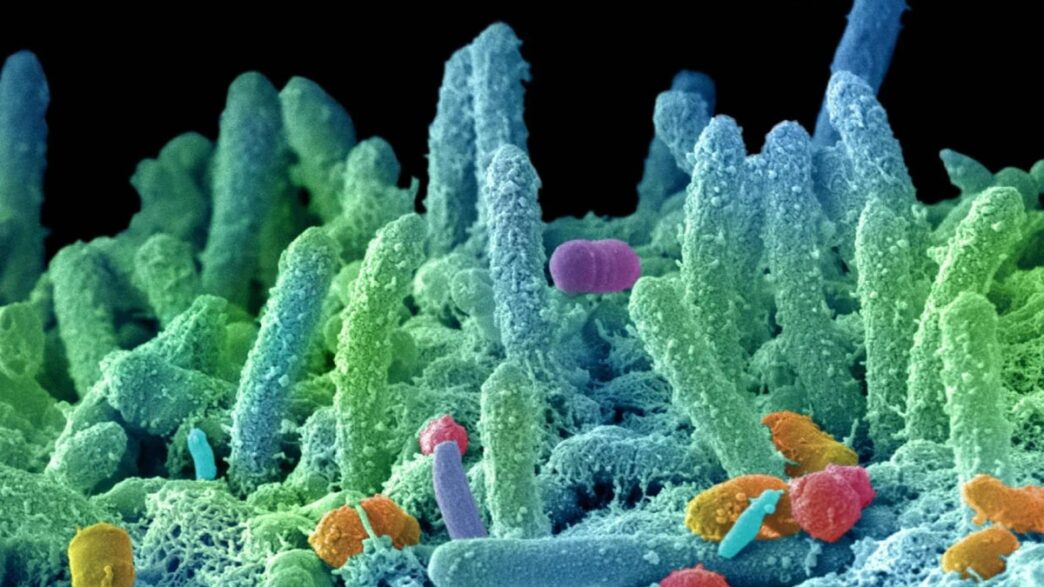 Super batteri, appello dei microbiologi: fondi certi e visione One Health per frenare l’antimicrobico resistenza