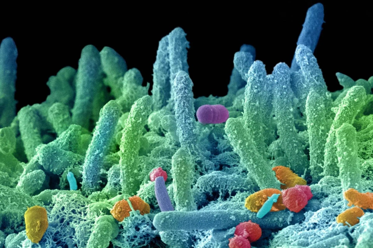 Super batteri, appello dei microbiologi: fondi certi e visione One Health per frenare l’antimicrobico resistenza